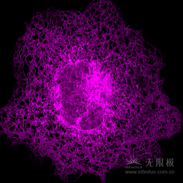 先進光學顯微成像顯示單個細胞內部的內質網